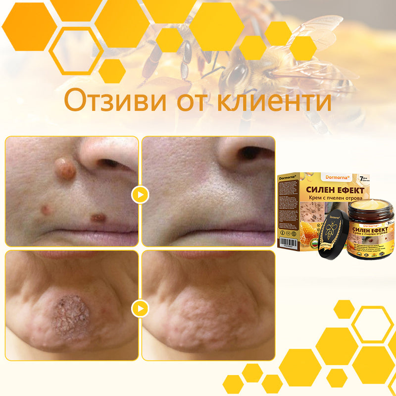 🍋‍🟩✅Dormorna® Силен ефект Крем с пчелен отрова – ✨Препоръчван от експерти по дерматология. Ефективен срещу брадавици, издутини, лезии, инфекции и белези.🐝🐝