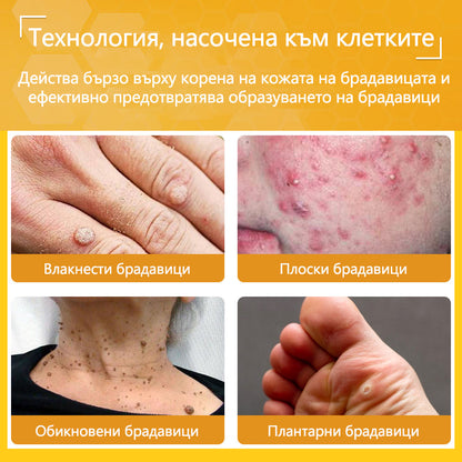 🍋‍🟩✅Dormorna® Силен ефект Крем с пчелен отрова – ✨Препоръчван от експерти по дерматология. Ефективен срещу брадавици, издутини, лезии, инфекции и белези.🐝🐝